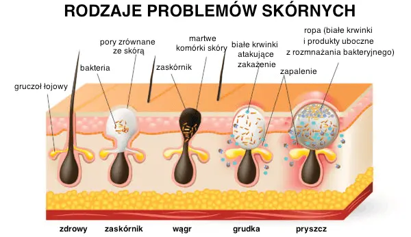 problemy skórne